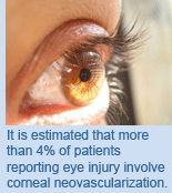 It is estimated that more than 4% of patients reporting eye injury involve corneal neovascularization.