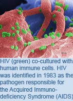 HIV (green) co-cultured with human immune cells. HIV was identified in 1983 as the pathogen responsible for the Acquired Immunodeficiency Syndrome (AIDS)