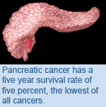 Pancreatic cancer has a five year survival rate of five percent, the lowest of all cancers.
