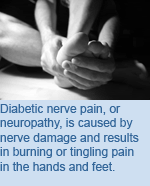 Diabetic nerve pain, or neuropathy, is cause by nerve damage and results in burning or tingling pain in the hands and feet