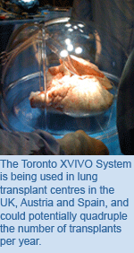 The Toronto XVIVO System is being used in lung transplant centres in the UK, Austria and Spain, and could potentially quadruple the number of transplants per year.