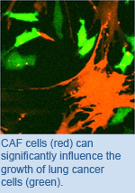 Co-cultured CAFs (red) can significantly influence the growth and invasiveness of lung cancer cells (green).