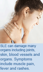 SLE can damage many organs including joints, skin, blood vessels and organs. Symptoms include muscle pain, fever and rashes.