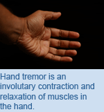 Hand tremor is an involuntary contraction and relaxation of muscles in the hand.