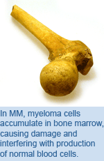 In MM, myeloma cells accumulate in bone marrow, causing damage and interfering with production of normal blood.