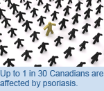 Up to 1 in 30 Canadians are affected by psoriasis.