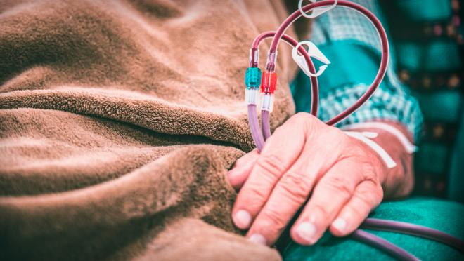 A close up photograph of a patient's hand with a blood IV.