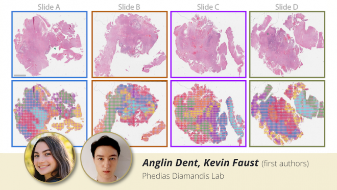 Figure from Phidias' paper published on Science Advances showing four histology slides with their respective HAVOC maps