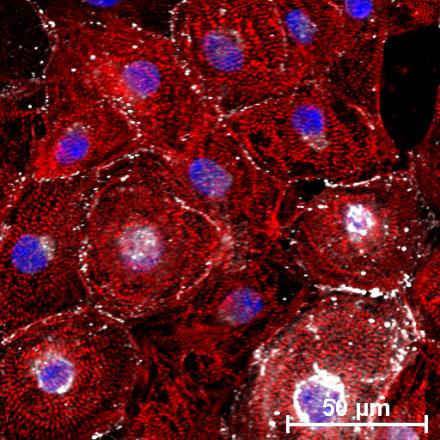 microscopic image of stem cell induced cardiomyocytes stained with markers for various cell components