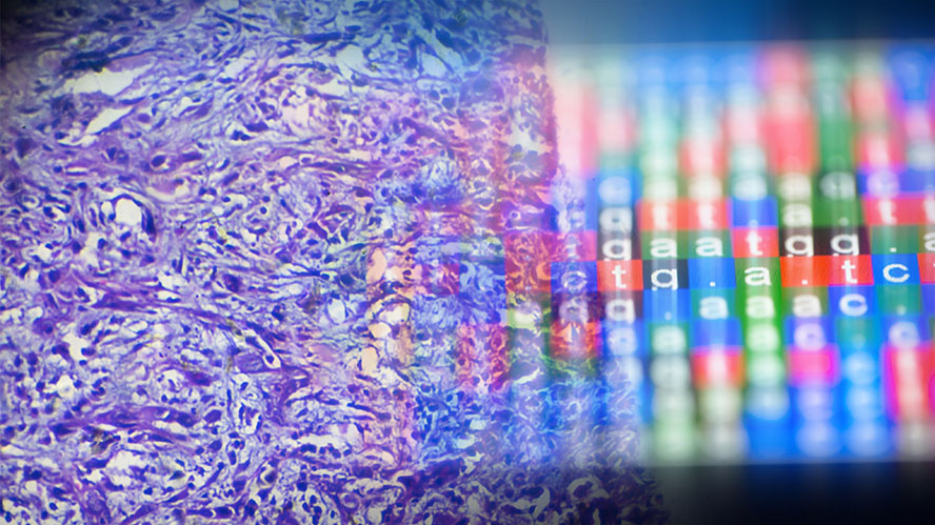 Image of tumour tissue superimposed with illustration of gene sequences