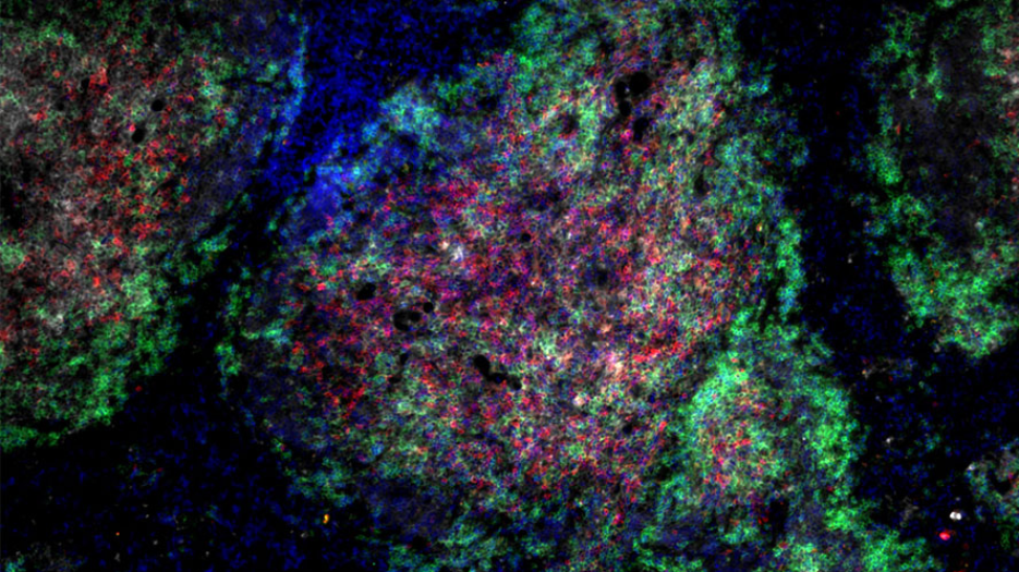 Scientific image of spleen cells stained for T cells and B cells