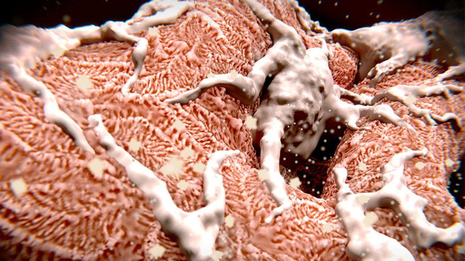 Close-up image of a kidney, showing patterning of podocytes