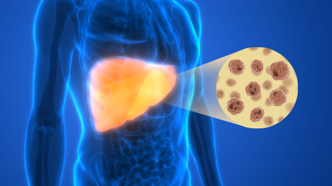 The liver is the largest solid organ. It filters a third of the body's total blood volume each minute and contains large populations of immune cells (illustrated above).