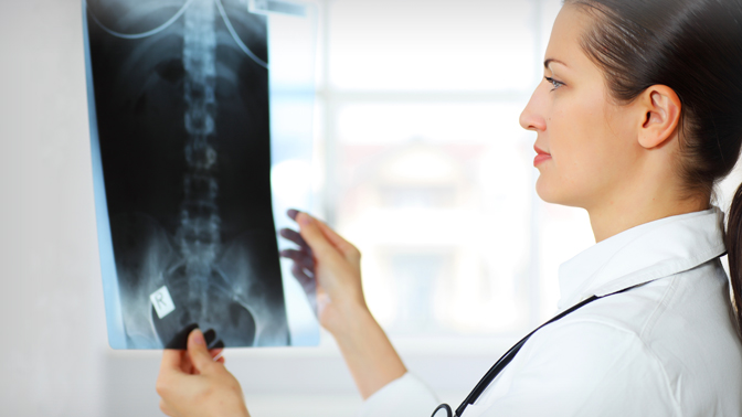 Although back X-rays can reveal inflammation in back joints, which is a sign of potentially severe psoriatic arthritis (PsA), they are not routinely performed on PsA patients.