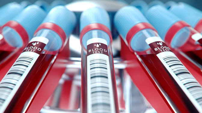 Using a blood test to detect cancer would be more convenient and less invasive than using tissue biopsies.