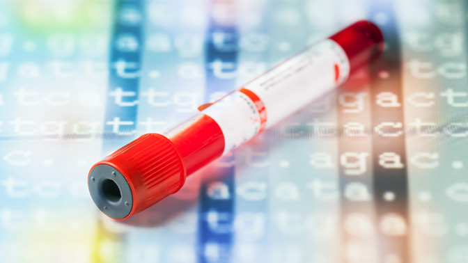 Findings from the study could be used to create a simple blood test capable of identifying those at risk of developing acute myeloid leukemia up to 10 years before the disease strikes.