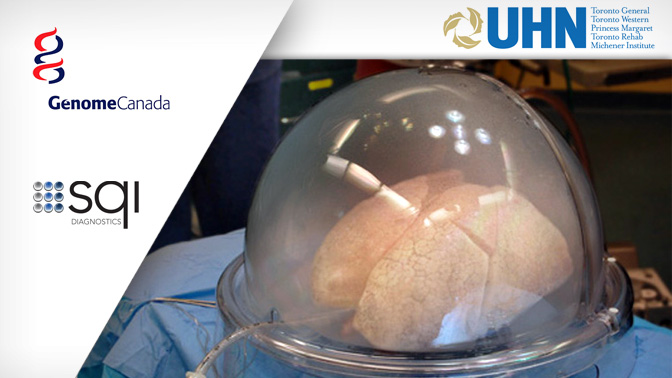 UHN is a leader in improving the utilization of donor lungs, finding biomarkers to predict transplant success and in developing the Ex Vivo Lung Perfusion method (pictured) to preserve function.