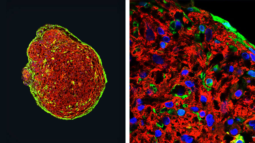 (L) Whole organoid showing cardiomyocytes dyed in red and epicardium in green. (R) Magnified x5 view of a section from the left image.