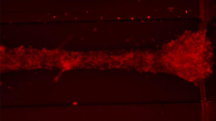 Microscope image of cells stained red on a dark background