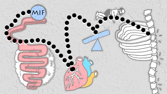 This study reveals that MIF released from cells in the intestine can travel through the blood stream to the spine, where it transforms soft tissue into bone and leads rigidity and pain.
