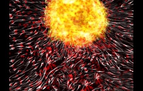 Cell Supernova by PhD Candidate Danielle Spice was awarded the Grand Prize in the annual Cells I See art contest at Till and McCulloch Meetings.