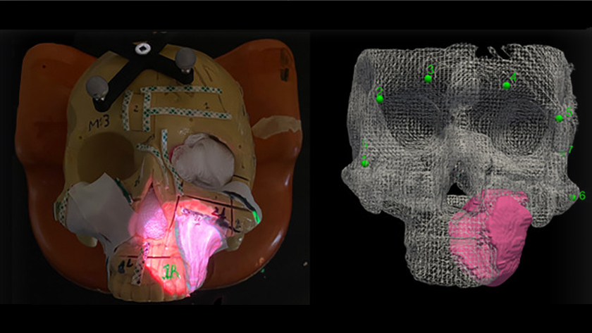 A demonstration of augmented reality in surgery, with a tumour (pink) projected on to a plastic skull (left) based on medical imaging data of the tumour's size, shape and position (right). 