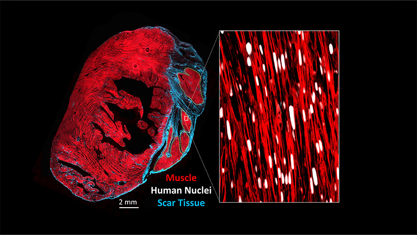 A cross-section through an injured heart that has been transplanted with stem cell-derived heart muscle cells matured using the methods developed in this study.