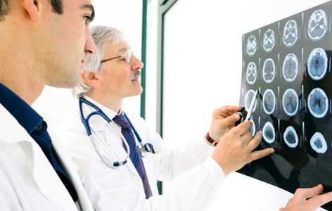 The effects of a strokesuch as paralysis, memory loss and changes in behaviourdepend on several factors, including the location of the obstruction.