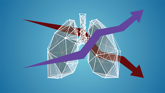 More than 2,000 Canadians are living with a lung transplant, and in 2019 the number of lungs transplanted exceeded 400.