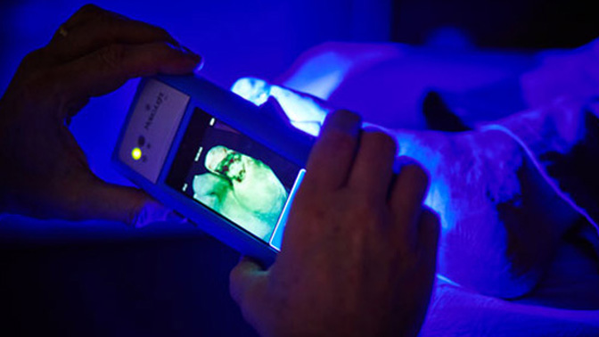 The MolecuLight i:X optical imaging device enables clinicians to quickly, safely and easily visualize the presence and distribution of clinically important levels of bacteria on the skin and in wounds (Photo courtesy of MolecuLight Inc).