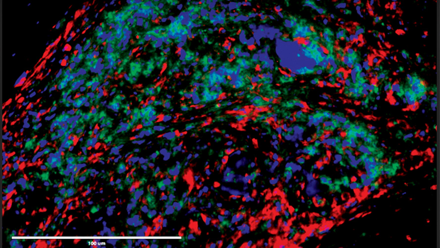 Microscope image of immune cells. There are a mix of blue, green and red stained cells on a dark background.