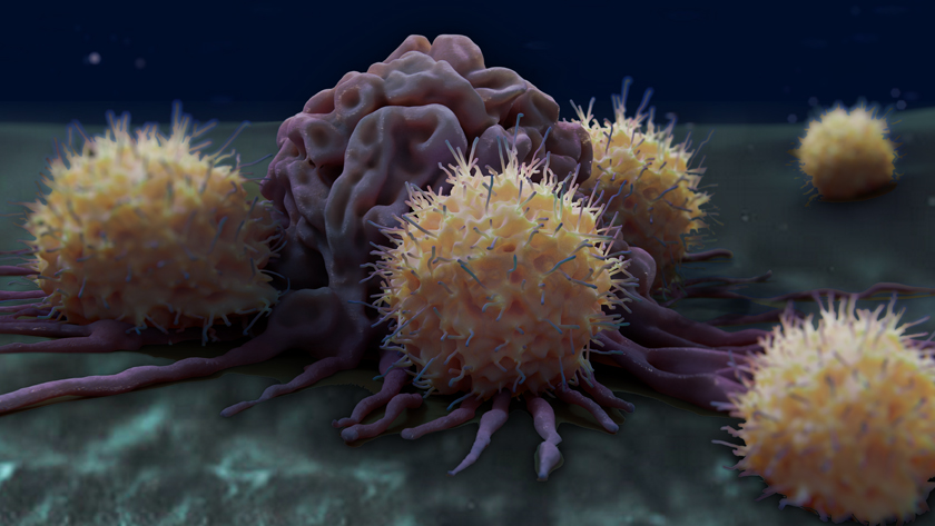Adoptive cell therapy can be used to treat cancer. The therapy involves transferring a type of immune cell known as a T cell into patients. The T cells (illustrated in yellow, surrounding a cancer cell) have been primed to target and destroy the cancer.