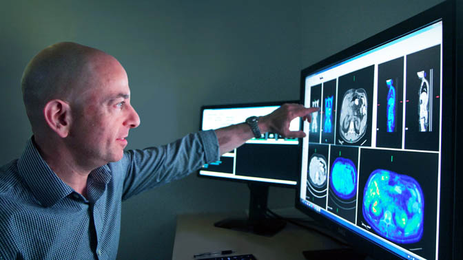 Dr. Metser examining PET, CT and the combined PET/CT images of a patient's abdomen.