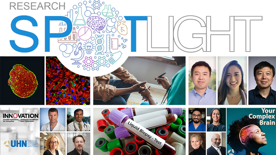 Researchers and research being spotlighted at UHN.