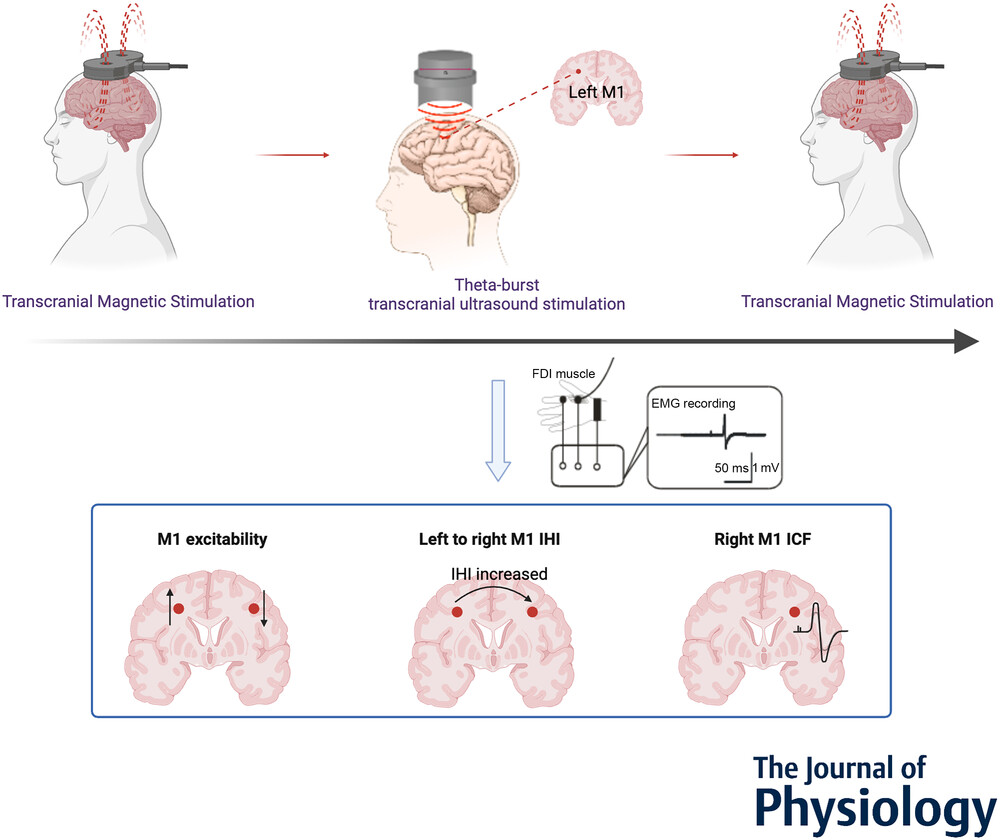 Visual abstract of new ultrasound technique modulating brain activity.