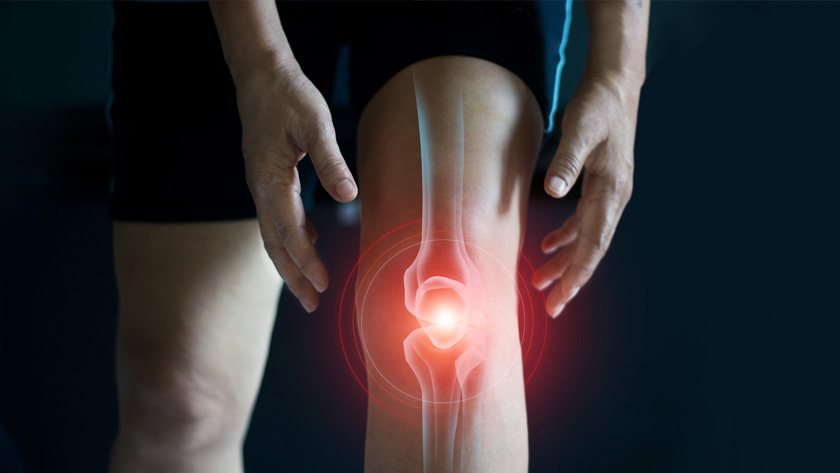 Osteoarthritis is a degenerative joint disease that commonly affects the hands, neck, back, hips and knees. Treatments include medications for pain relief, physical therapy and surgery.