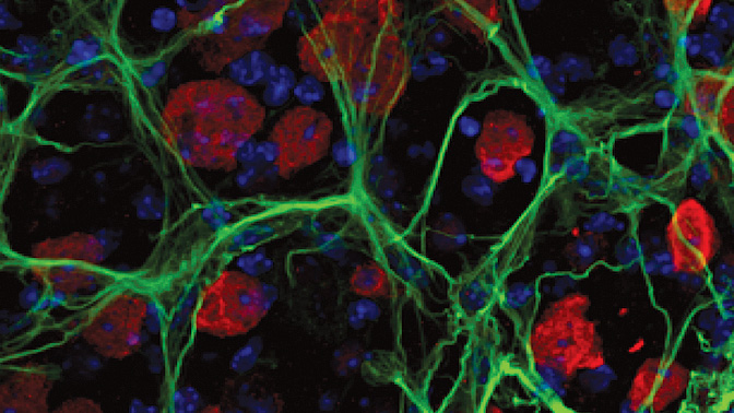 Retinal astrocytes (shown here in green) are star-shaped helper cells that surround the neurons (red) in the retina. Photo courtesy of Alessandra Tuccitto.