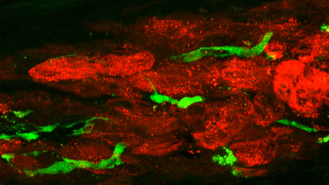 The above image, which was prepared using fluorescence microscopy, shows implanted heart cells (red) and ready-made blood vessels (green). 
