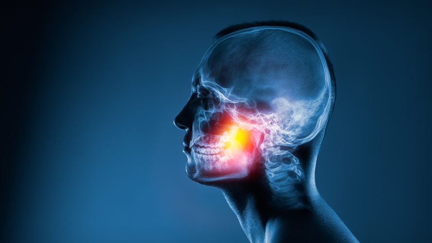 X-ray image of human skull with jaw bone highlighted.