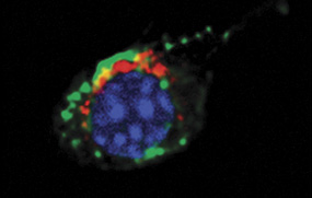 In cells undergoing autophagy, specialized structures called autophagosomes (red in the microscope image above) use acids to break down unwanted cellular components.