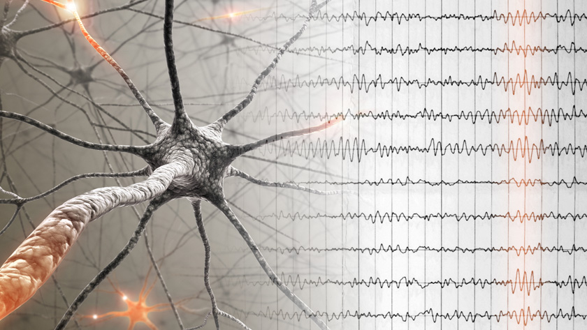 Neurons are brain cells that communicate through electrical and chemical signals. When large groups of neurons are activated simultaneously, they generate patternsor rhythmsof brain activity, which can be distinguished based on their frequencies.