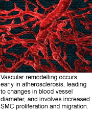 Vascular remodelling occurs early in atherosclerosis.