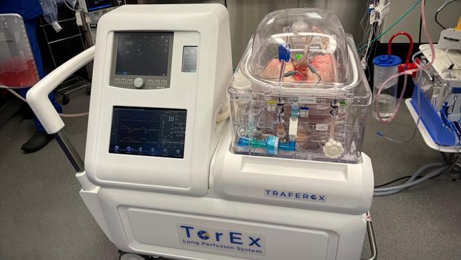 Photograph of the TorEx EVLP system in use.